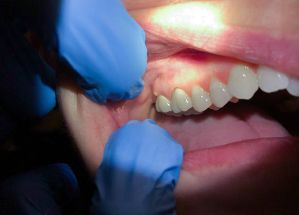 Best Pediatric Emergency Dentist in Ottumwa, IA